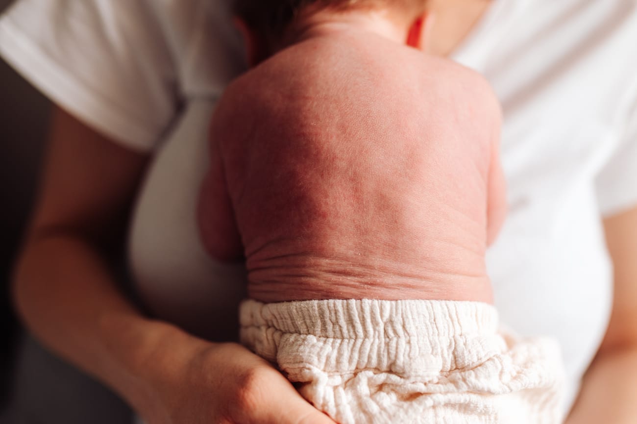 Skóra noworodka detal sesja noworodkowa w domu