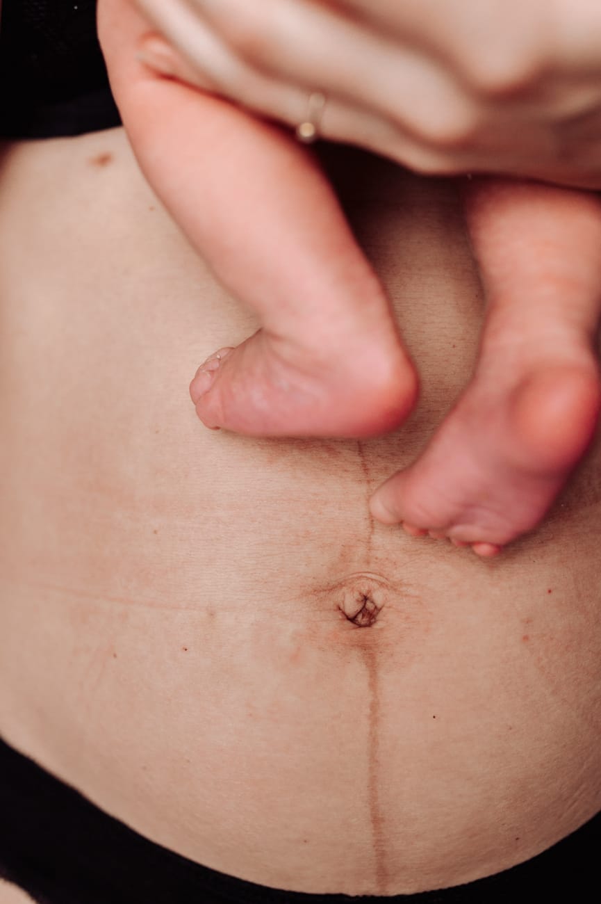 Mama z noworodkiem brzuch poporodowy sesja lifestyle Gdynia