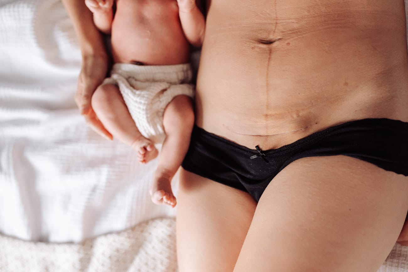 Brzuch poporodowy i noworodek sesja lifestyle Gdynia